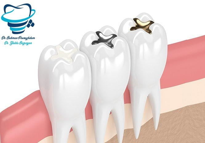 عوامل پوسیدگی دندان