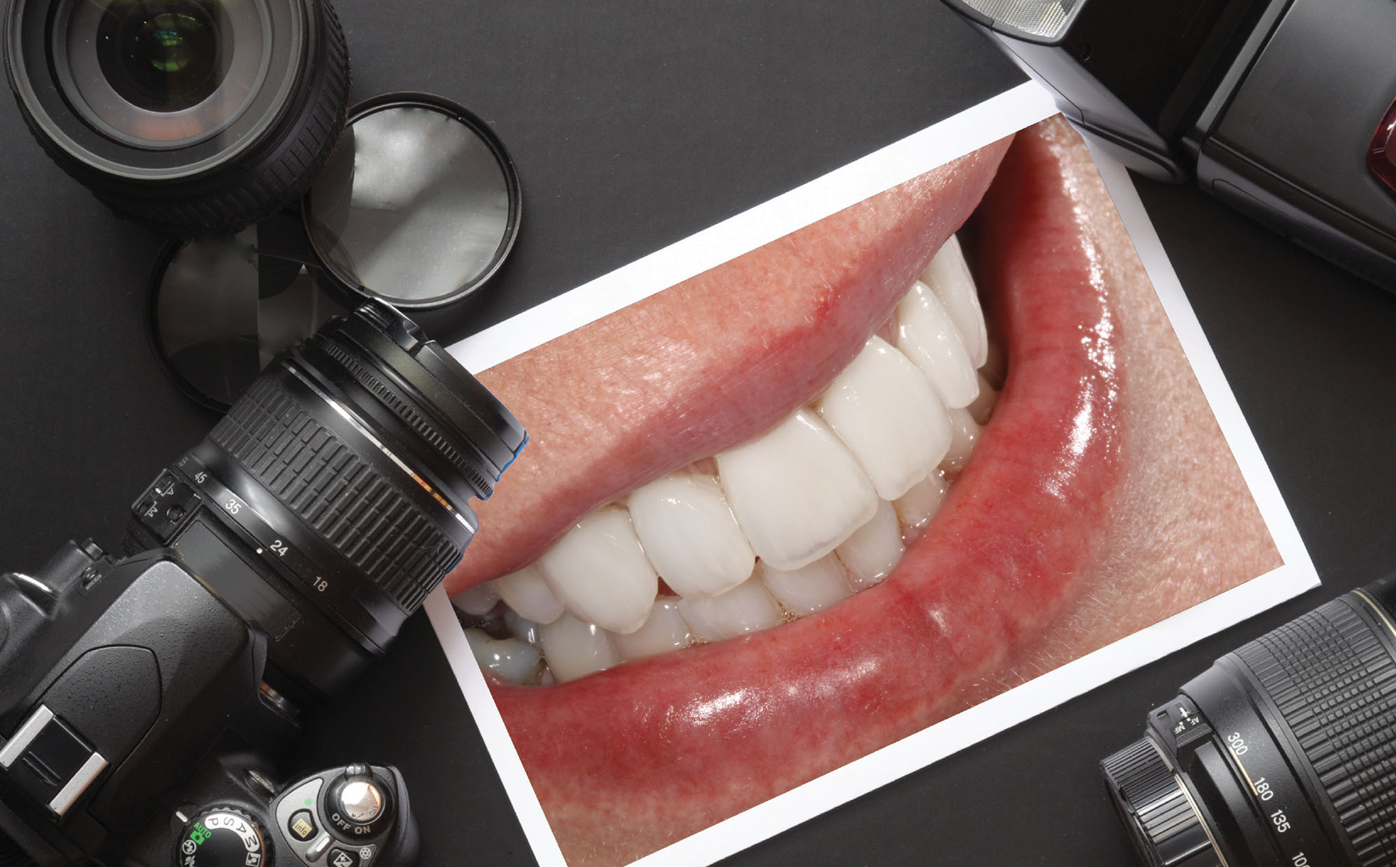 انواع عکس برداری از دندان