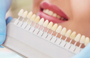عکس از افزایش طول عمر روکش دندان